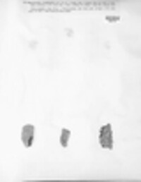 Pertusaria pertusa image